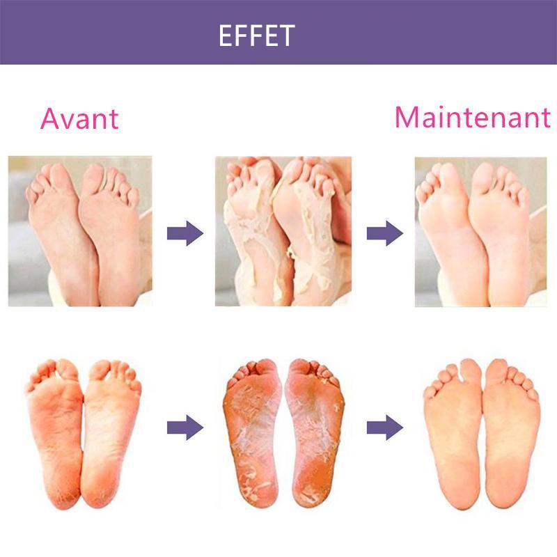 Masque Pour Pieds-Enlever Callosité et Peaux Mortes