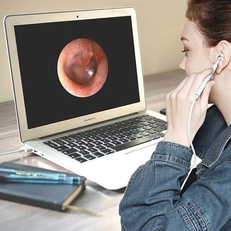 🔥Caméra d'Endoscope WiFi Semi-rigide à Mise au Point Automatique